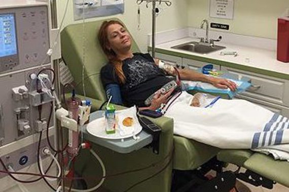 In-Center Hemodialysis