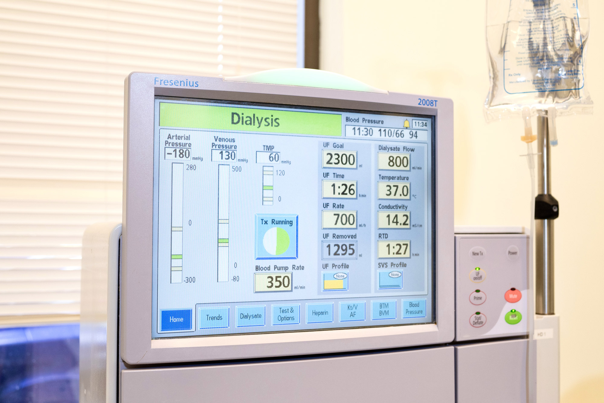 WORLD-CLASS CARE WITH MODERN DIALYSIS TECHNIQUES (slider)